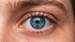 Come sollevare le palpebre cadenti? Le 3 cause principali e i metodi di correzione