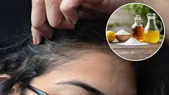 Quali sono i vantaggi dell'uso dell'aceto e del bicarbonato di sodio per rimuovere i capelli grigi e come farlo correttamente?